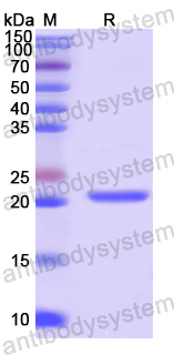 Recombinant Human UACA Protein, N-His
