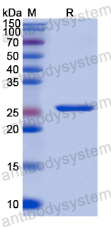 Recombinant Human PRKD2 Protein, N-His
