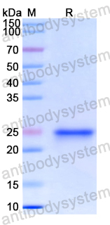 Recombinant Human CD244 Protein, N-His