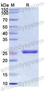 Recombinant Human CD169/SIGLEC1 Protein, N-His