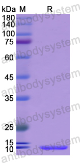 Recombinant Human PKIB Protein, N-His