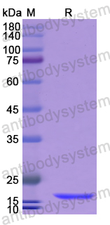 Recombinant Human KRT23 Protein, N-His