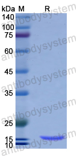 Recombinant Human LC3B/MAP1LC3B Protein, N-His