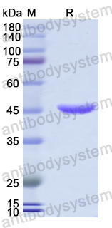 Recombinant Human WWTR1 Protein, N-His