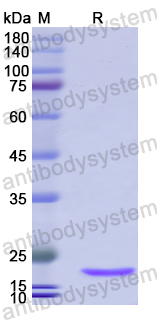 Recombinant Human AICDA Protein, N-His