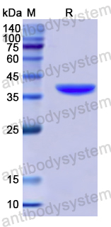 Recombinant Human LACRT Protein, N-GST