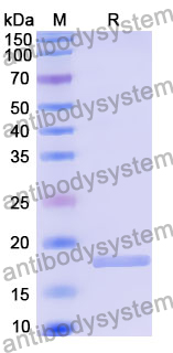 Recombinant Human LACRT Protein, N-His-SUMO