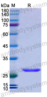 Recombinant Human TOLLIP Protein, N-His