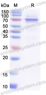Recombinant Human RACGAP1 Protein, N-GST