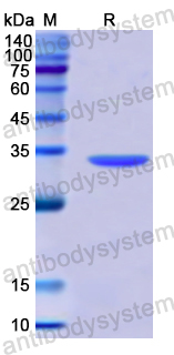 Recombinant Human NT5C3A Protein, N-His
