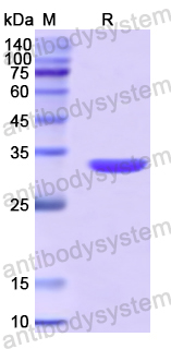 Recombinant Human SDCBP2 Protein, N-His
