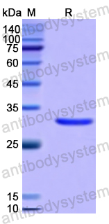 Recombinant Human MYLK2 Protein, N-His