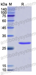 Recombinant Human SPTBN4 Protein, N-His