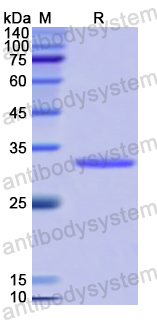 Recombinant Human CARD9 Protein, N-His