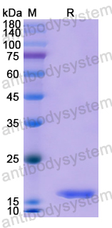 Recombinant Human CXCL16/SR-PSOX Protein, N-His