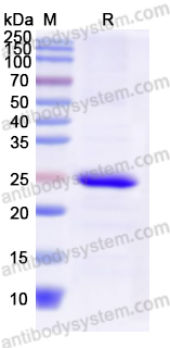 Recombinant Human TNKS2 Protein, N-His