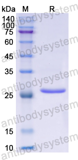 Recombinant Human CHRD Protein, N-His