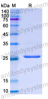 Recombinant Human FOXP1 Protein, N-His