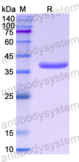 Recombinant Human TXNIP Protein, N-His