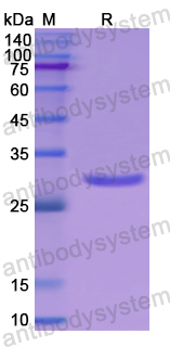 Recombinant Human CENPH Protein, N-His