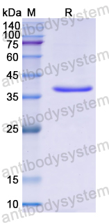 Recombinant Human FN3K Protein, N-His