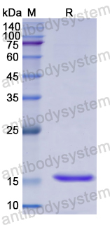 Recombinant Human MAP1LC3A Protein, N-His