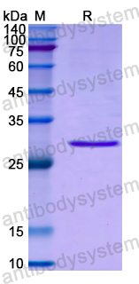Recombinant Human RNPEP Protein, N-His