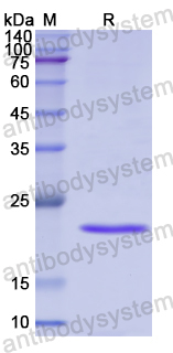 Recombinant Human DPEP2 Protein, N-His