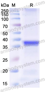 Recombinant Human TUBB1 Protein, N-His