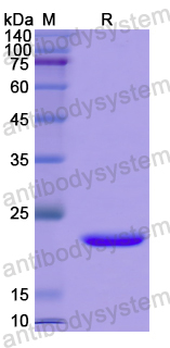 Recombinant Human XKR8 Protein, N-His-SUMO