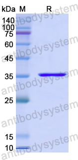 Recombinant Human BCAS3 Protein, N-His