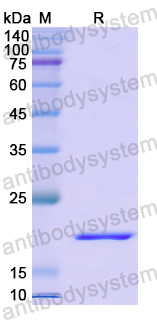 Recombinant Human MMRN2 Protein, N-His