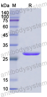 Recombinant Human FBRS Protein, N-His