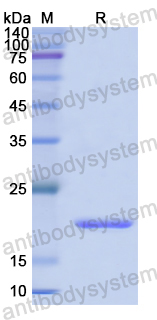 Recombinant Human SMURF2 Protein, N-His