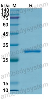 Recombinant Human PLEKHA1 Protein, N-His