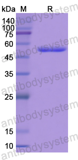 Recombinant Human NTN4 Protein, N-GST