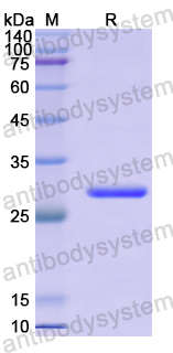 Recombinant Human CACYBP Protein, N-His