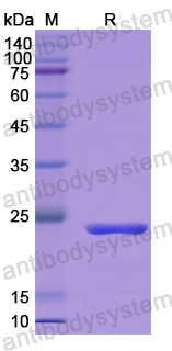 Recombinant Human PIDD1 Protein, N-His