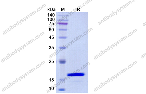 Recombinant Human IL21 Protein, C-His