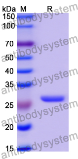 Recombinant Human CD360/IL21R Protein, N-His
