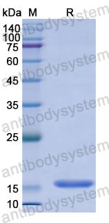 Recombinant Human CLTRN Protein, N-His