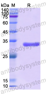 Recombinant Human SGK2 Protein, N-His