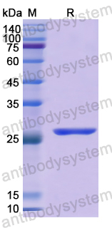 Recombinant Human SPON1 Protein, N-His