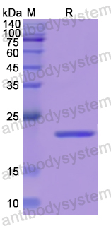 Recombinant Human SDF2L1 Protein, N-His