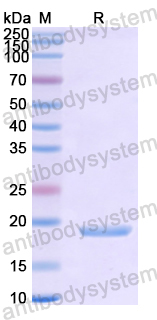 Recombinant Human FGF22 Protein, N-His