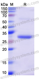 Recombinant Human CD248 Protein, N-His