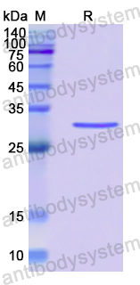 Recombinant Human PTPRH Protein, N-His