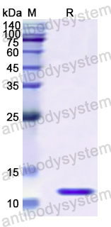 Recombinant Human RETN Protein, N-His
