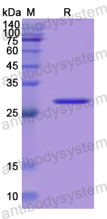 Recombinant Human APMAP Protein, N-His
