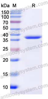 Recombinant Human CD209 Protein, N-His